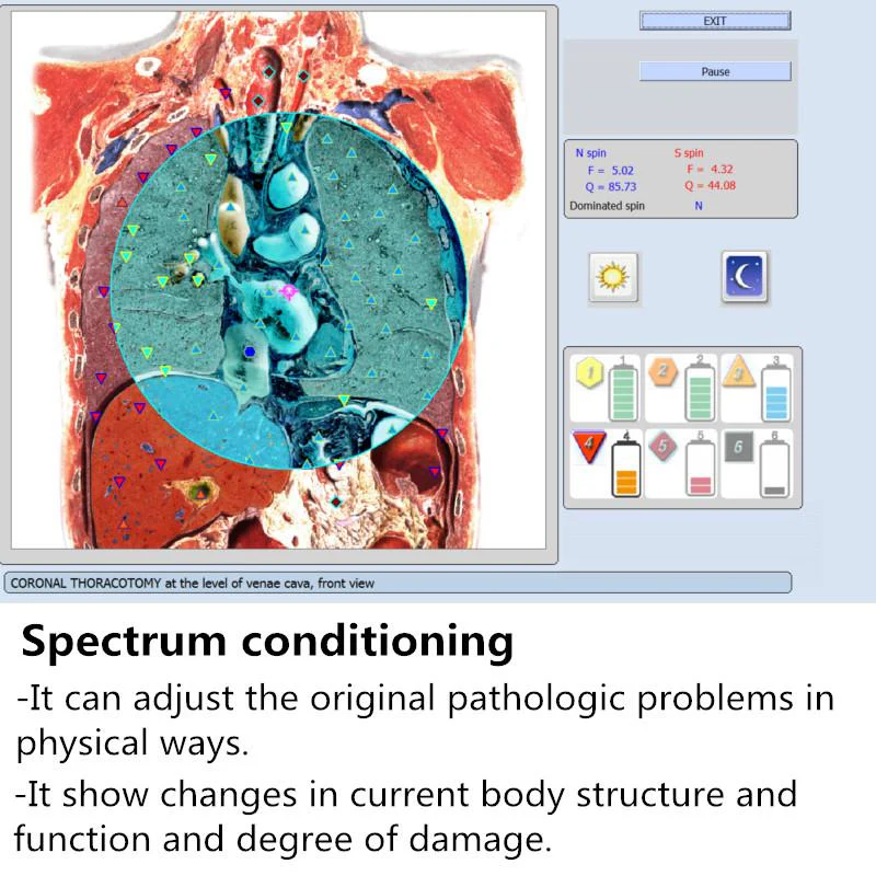2021 Multilingual 9D NLS Cell Diagnostics Bioresonance Sub Health Body Analyzer Diacom Quantum Bioresonance - Image 4