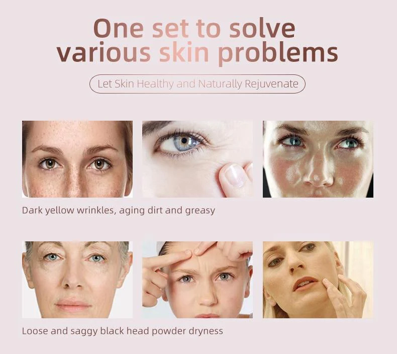 5 in 1 Quantum Hydro-Optical Facial Beauty Apparatus Skin RF Lifting EMS Mesotherapy Skin Rejuvenation Vacuum Hydration - Image 7