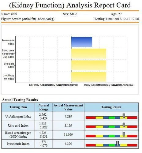8G Quantum Resonance Magnetic Japanese Technology Body Analyzer Machine for Full Body Check Up 45 Reports - Image 7