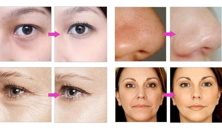 DCOOL Portable Cool + Hot + EMS For Skin Tightening Anti Puffiness Facial Heating Cooling And Facial Electroporation Machine - Image 10