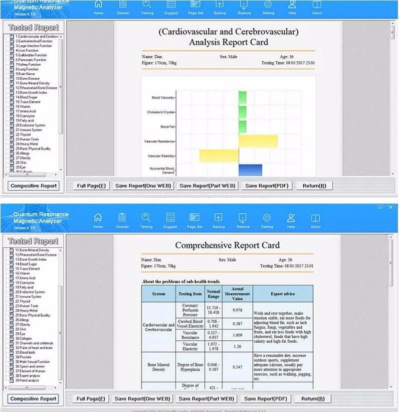 Latest sensing touch Quantum Resonance Magnetic Analyzer Body Analyzer - Image 10
