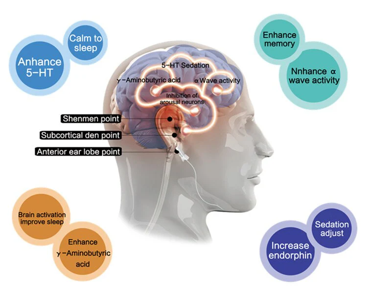 Newest Anti Insomnia Electrotherapy Alpha CES Stim Device for Anxiety Insomnia and Depression Cure Migraine Neuroticism - Image 3