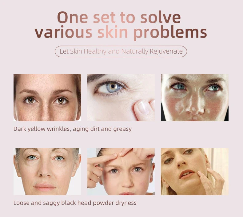 Multifunctional 5 in 1 Skin Care RF Lifting EMS Mesotherapy Facial Machine Skin Rejuvenation Vacuum Hydration beauty machine - Image 7