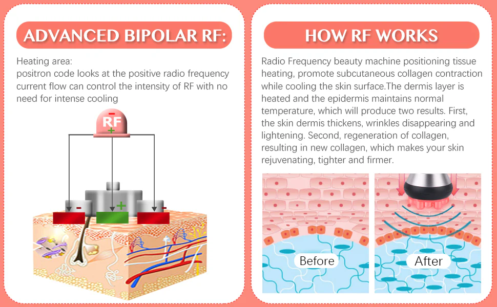 3 IN 1 RF Skin Tightening Machine Tripolar RF Radio Frequency Facial Lifting Machine Body Face Massager Wrinkle Remover Anti Aging Device - Image 10