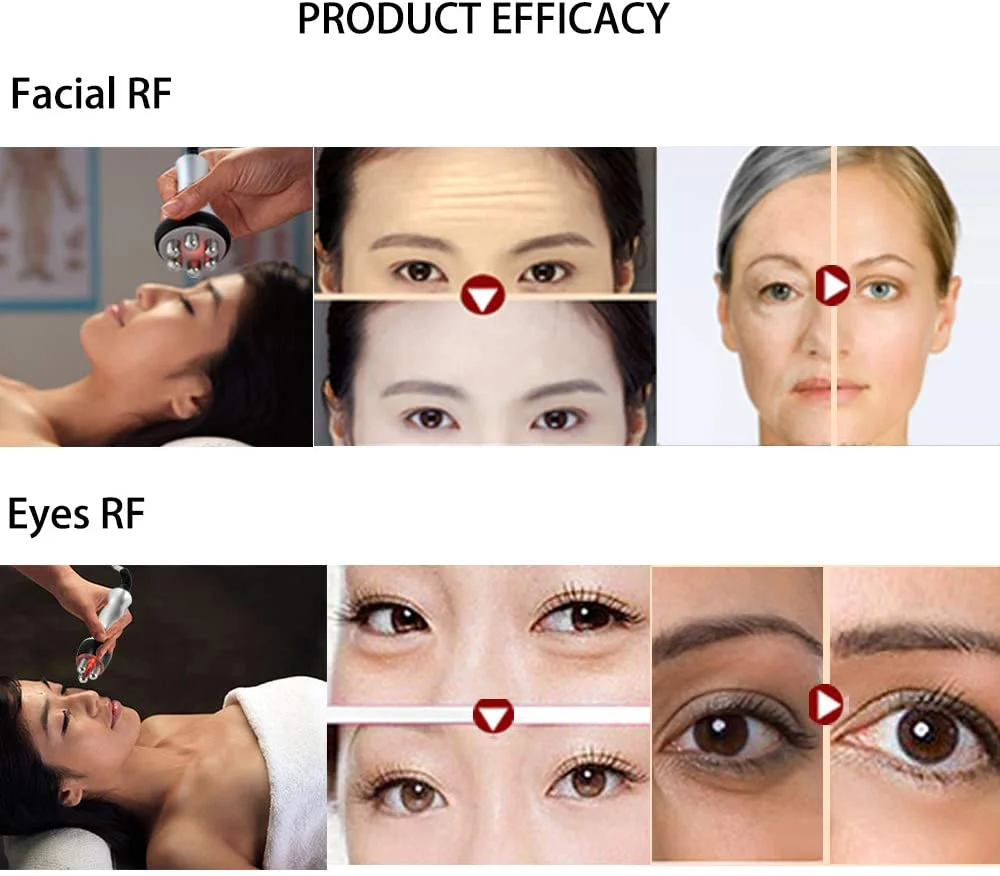 3 IN 1 RF Skin Tightening Machine Tripolar RF Radio Frequency Facial Lifting Machine Body Face Massager Wrinkle Remover Anti Aging Device - Image 8